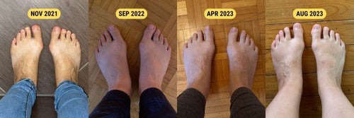 Iconic Foot Spa